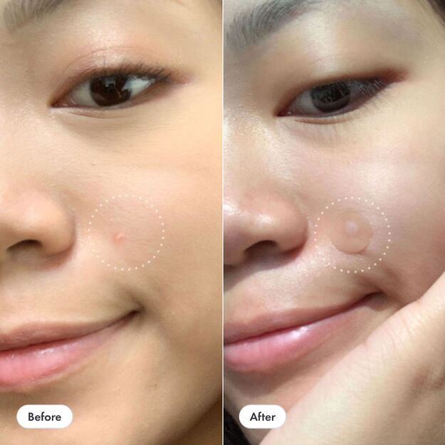 HERO Mighty Patch Invisible Plus 24ct