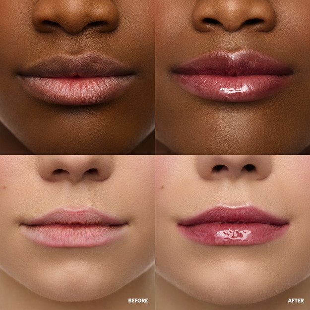 Wonderskin - Lip Rehab Serum Oil - Honey - 3.57 1