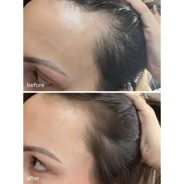 UKLASH- Ukhair Hair Growth Serum - 50ml