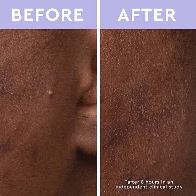 Florence by Mills - Skincare Cleanse Spot a Spot Patches 1 3