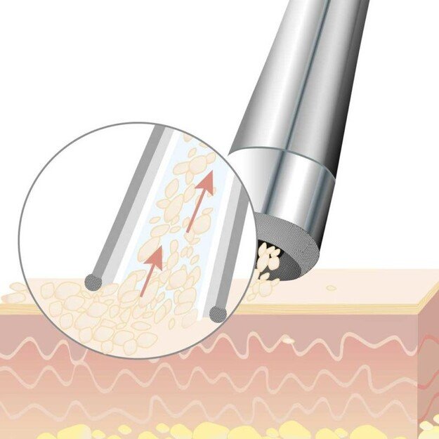 Beurer - FC 100 Pureo Derma Peel Microdermabrasion - 3 Years Warranty