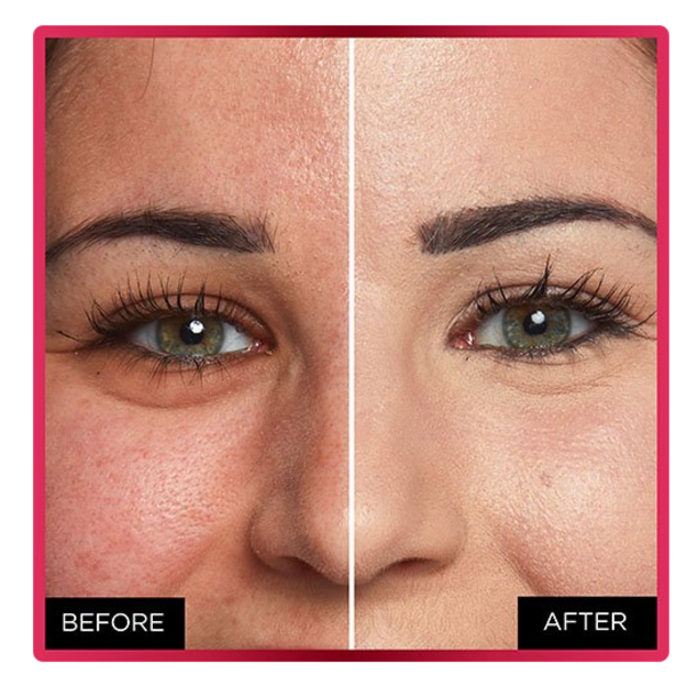 L'Oréal Paris - Infaillible More Than Concealer - 325 Bisque concealer