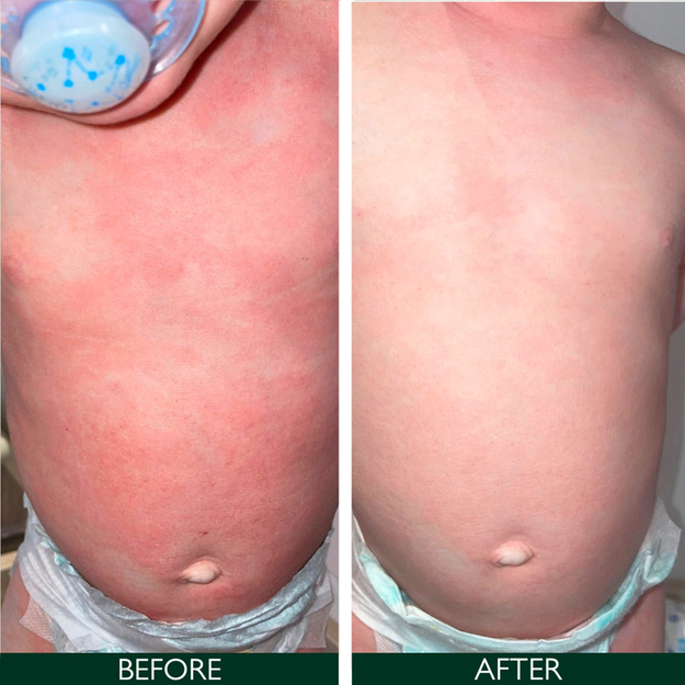 Sorted Skin - Intensive Rescue Spray 50 ml