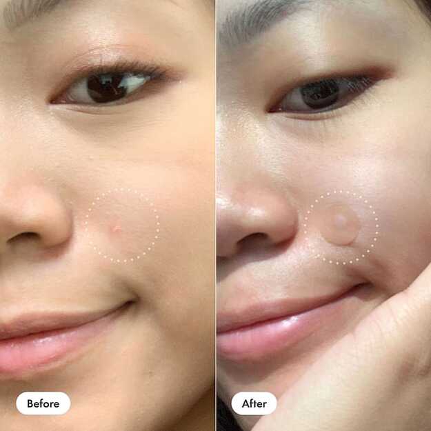 HERO Mighty Patch Original 24ct