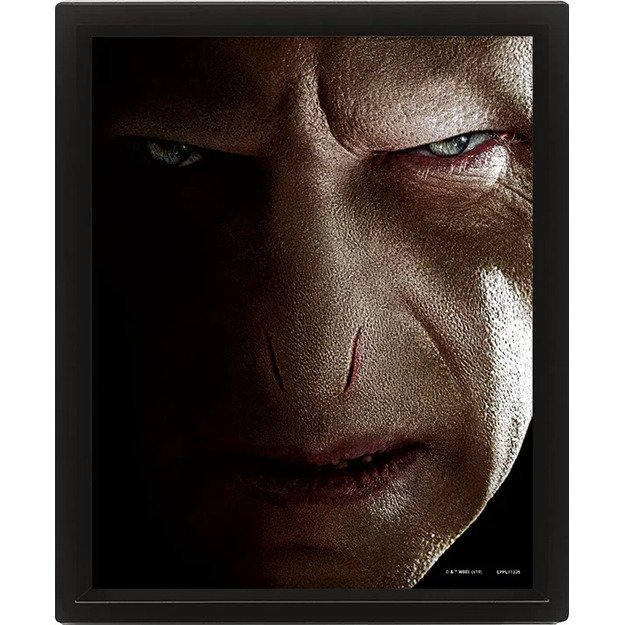 HARRY POTTER (HARRY VS VOLDEMORT) - FRAMED 1