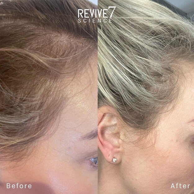 Revive7 - Hair Treatment 30 ml 3